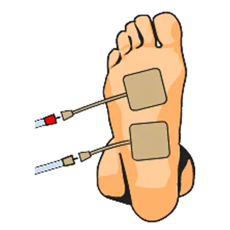 Compex Elektroden Wire, 5x5 cm, 4 Stck