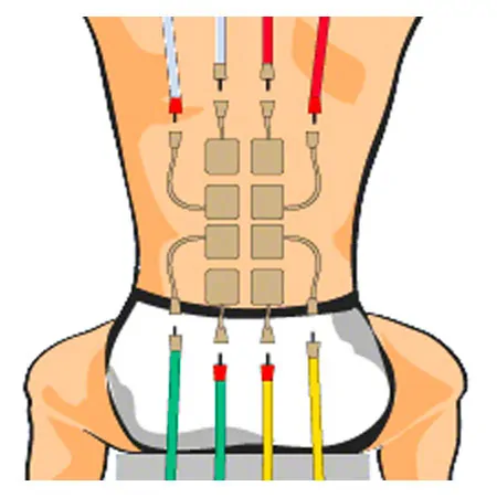 Compex Elektroden Wire, 5x5 cm, 4 Stck