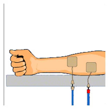 Compex Elektroden Wire, 5x5 cm, 4 Stck