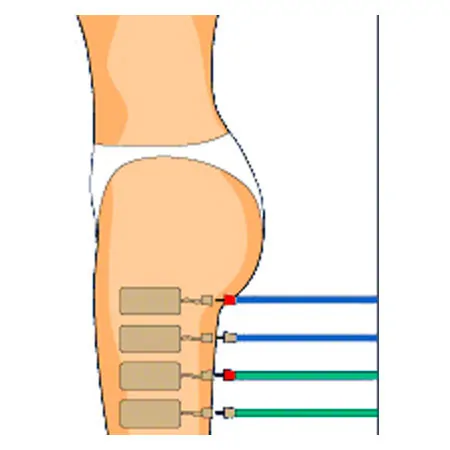 Compex Elektroden Wire, 5x10 cm, 2 Stck