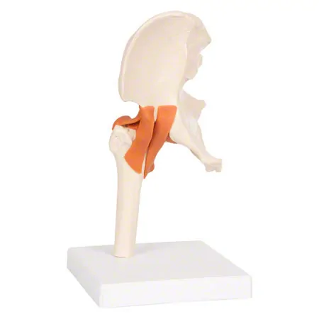 Anatomisches Modell Hftgelenk, LxBxH 17x17x23 cm