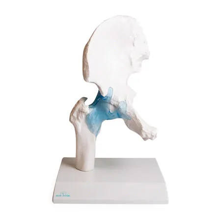 Hftgelenk, L x B x H 17 x 17 x 23 cm