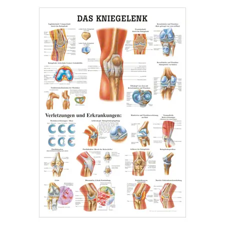 Lehrtafel Das Kniegelenk, LxB 100x70 cm