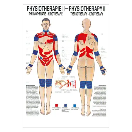 Mini-Poster Thermotherapie, LxB 34x24 cm