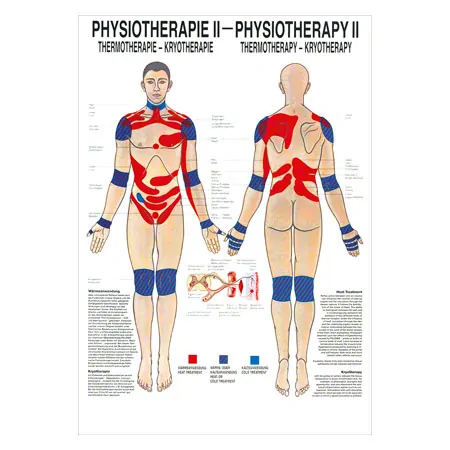 Poster Thermotherapie, LxB 70x50 cm