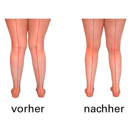 OrtoMalli Einlegesohlen