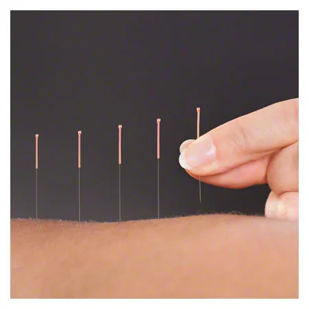 Akupunkturnadeln mit Kupferwendelgriff, 0,20x15 mm, 100 Stck