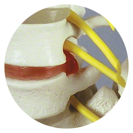 Anatomie-Set: Schädel 4-tlg. und Wirbelsäule mit Bandscheibenvorfall