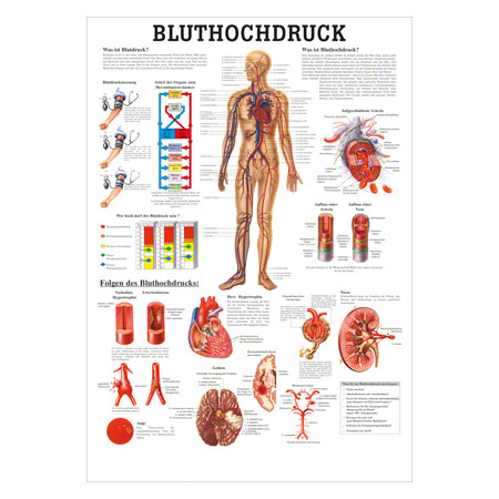 Poster Bluthochdruck, LxB 70x50 cm