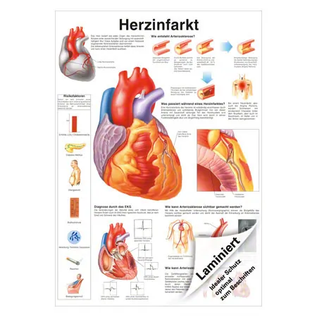 Poster Herzinfarkt, LxB 70x50 cm